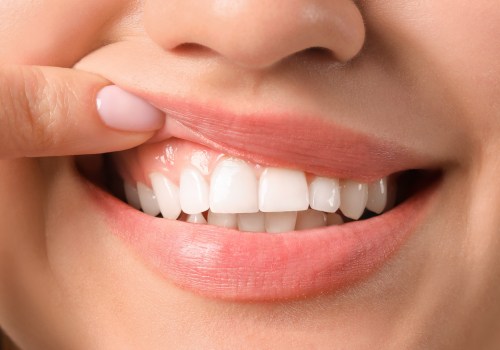 Best Cosmetic Dentist in San Diego: Your Guide to a Brighter Smile